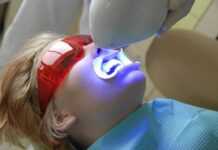 Wybielanie zębów foc5396