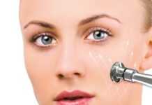 Mikrodermabrazja mikrodermabrazja